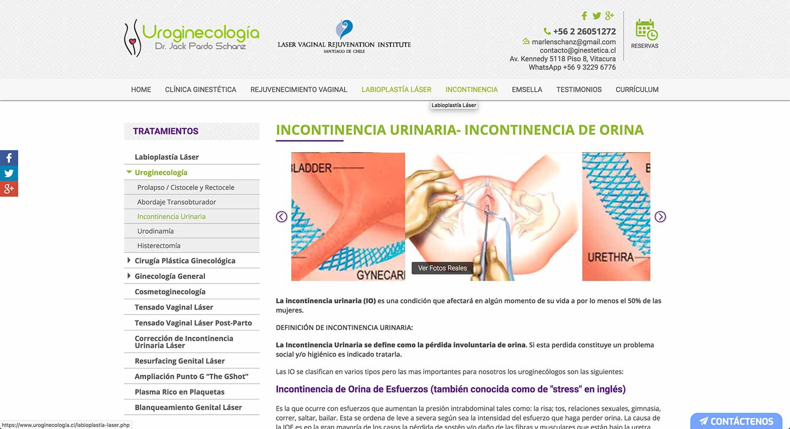 Incontinencia urinaria en Chile