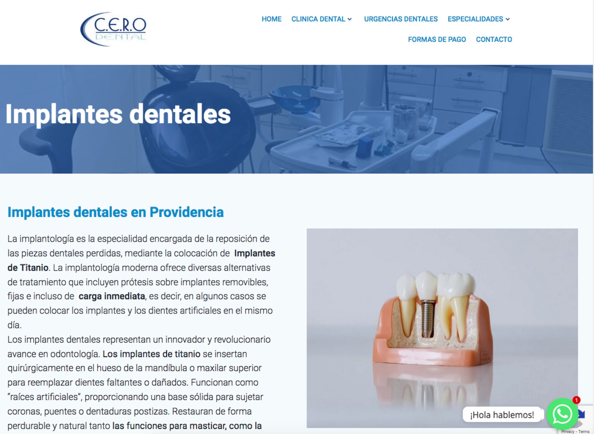 Urgencias dentales en las condes